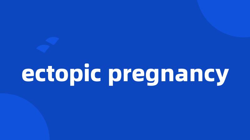 ectopic pregnancy