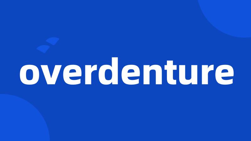 overdenture