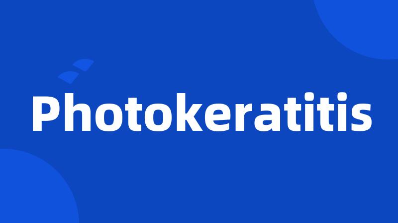 Photokeratitis